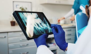 How Oral Health Screening Can Prevent Serious Diseases